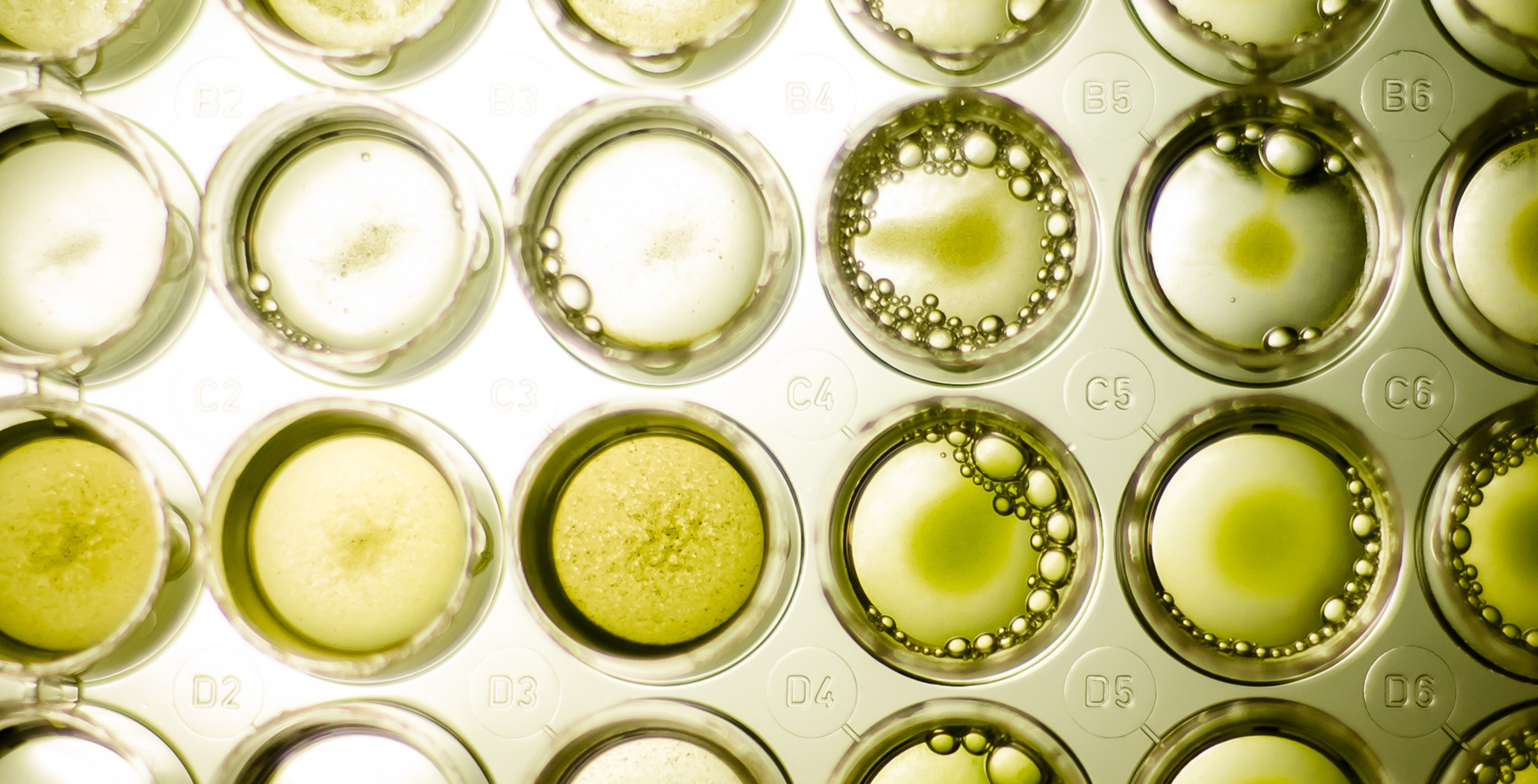 Algae Oil Market Trends: Global Demand, Applications & Future Outlook